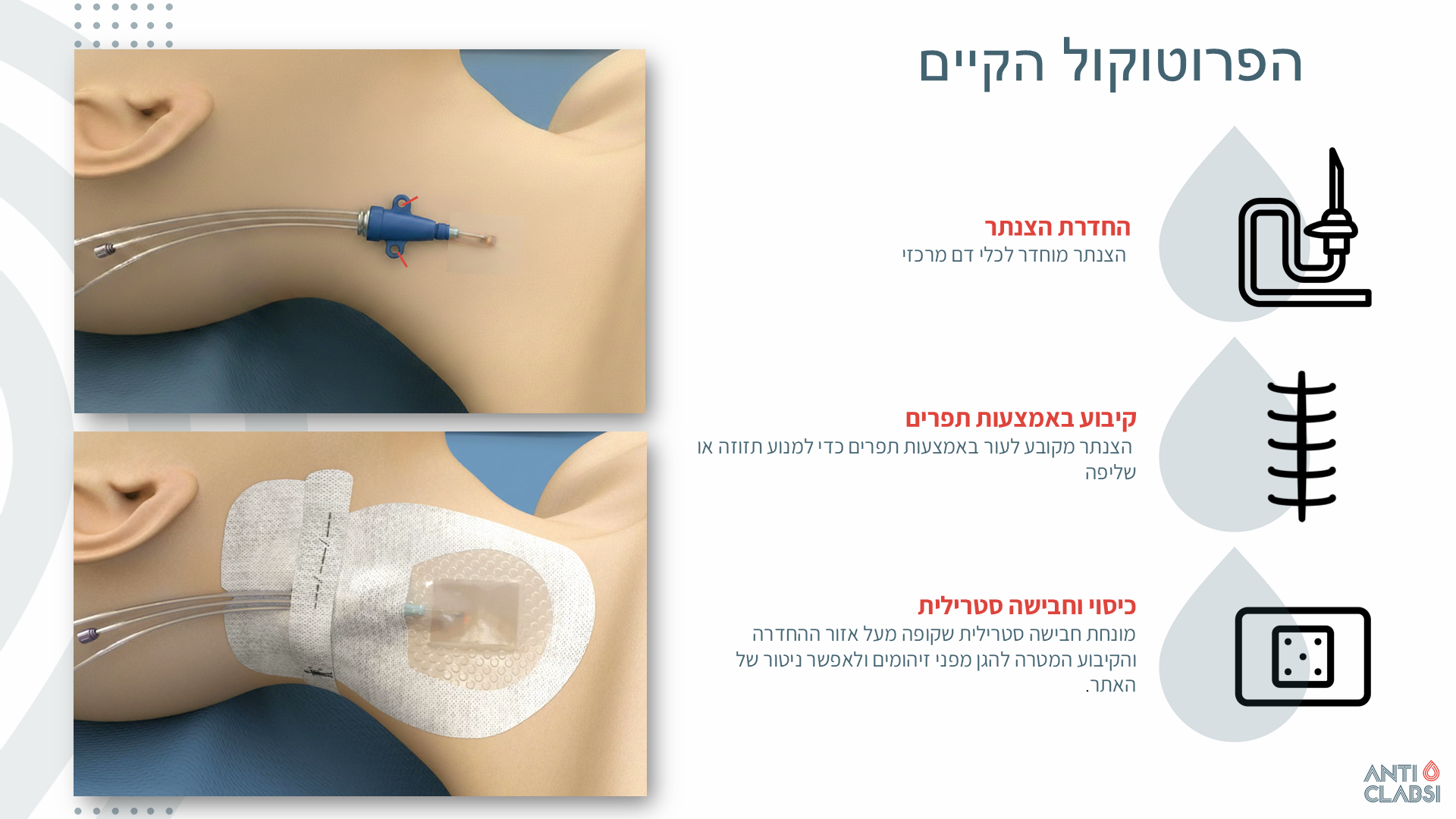 שקף 5
